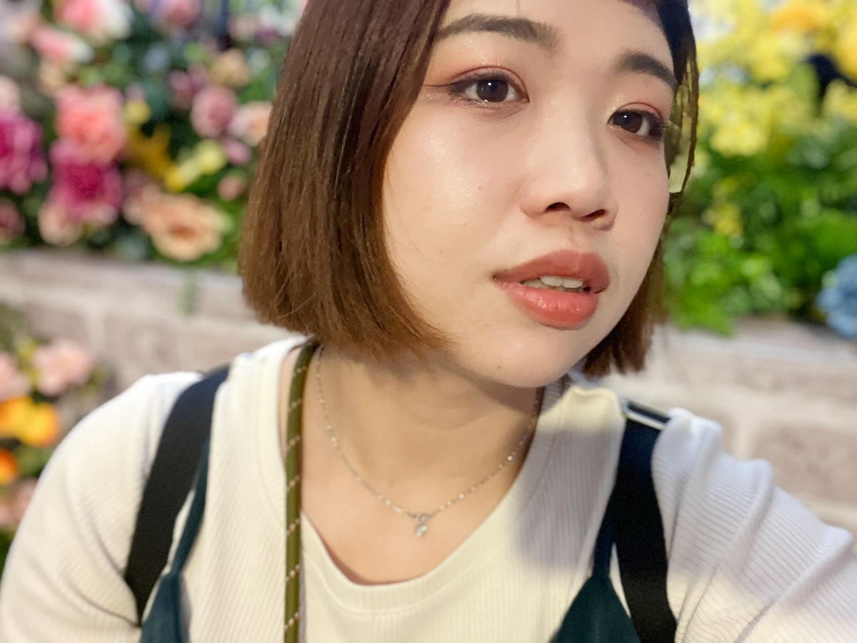 彤顏診所|超真實!雙下巴消失之術!Ronkyla 容脂針初體驗! - 第20張圖